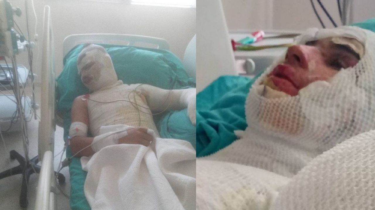 Kazada yaralanan 21 yaşındaki genç hayatını kaybetti