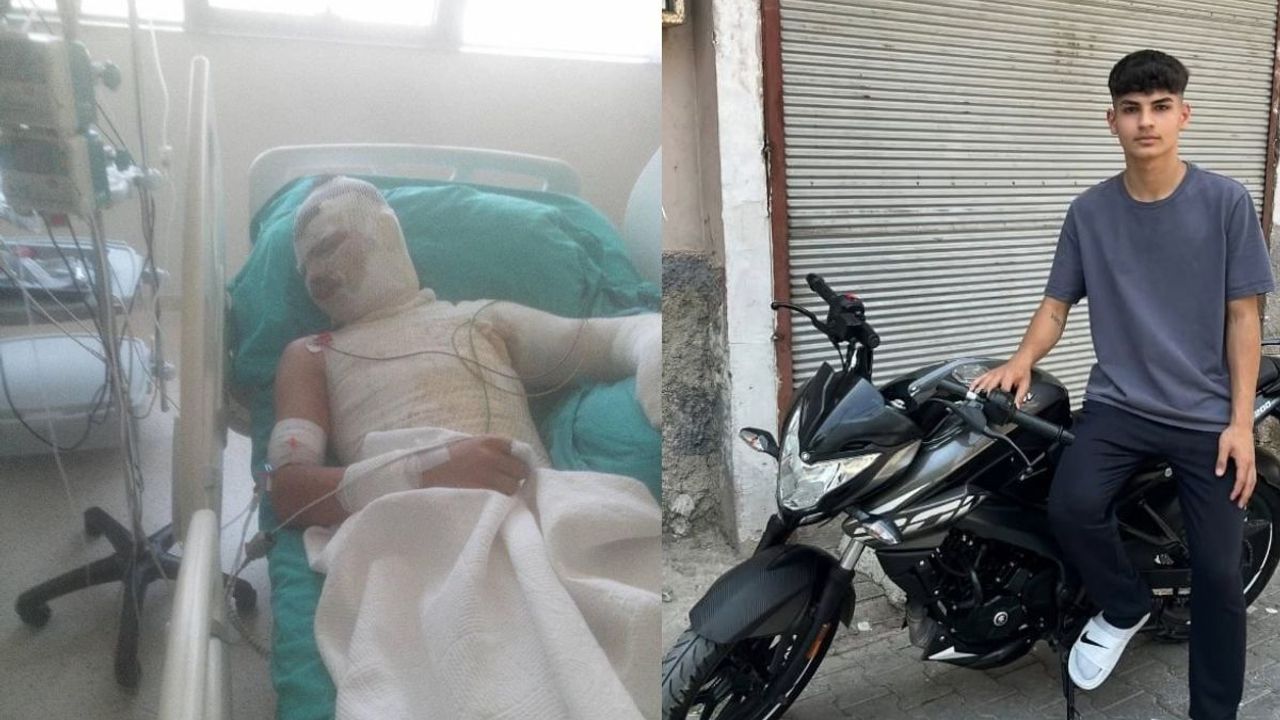 Miras davası yüzünden 16 yaşındaki yeğeninin üzerine benzin döküp yaktı!