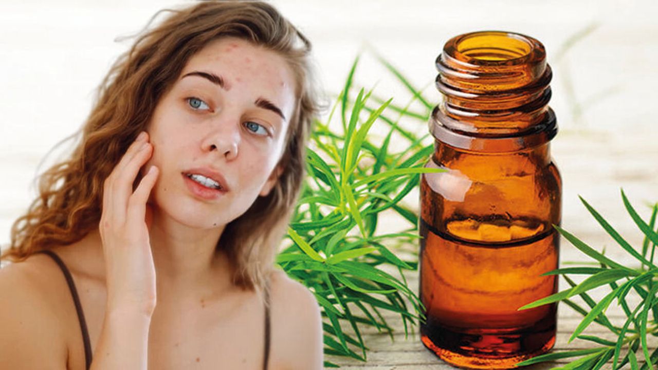 Çay Ağacı Yağı Akne veya Ayak Mantarını Tedavi Edebilir mi?