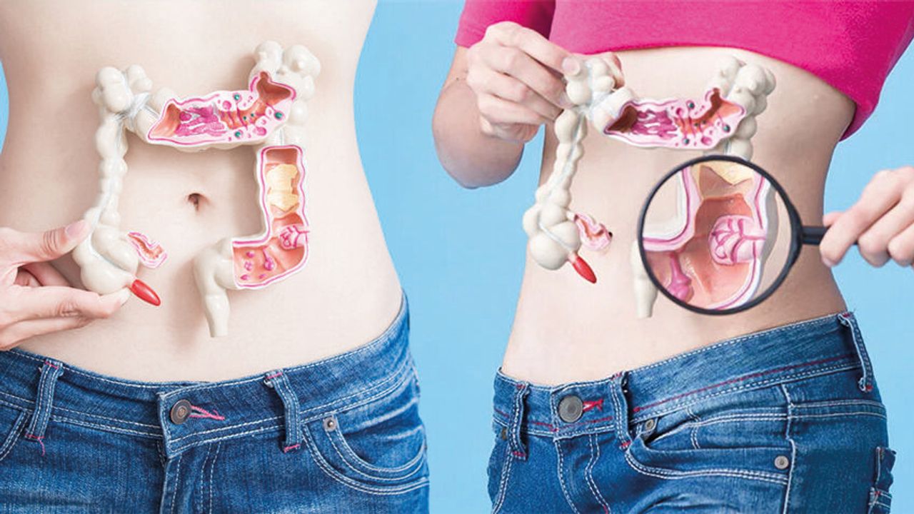 Kolon Kanseri Riskini Azaltmak İçin Tüketilecek Besinler