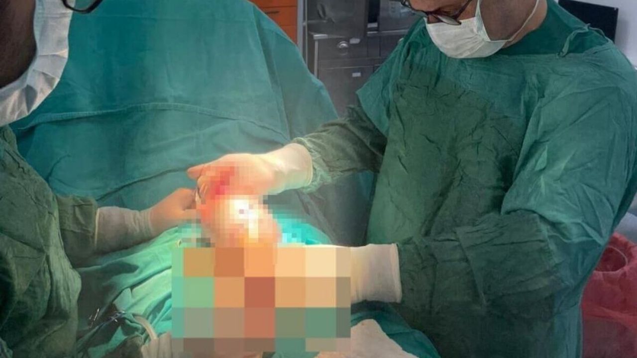 İdrar şikayetiyle gittiği hastanede testisinden çıkan şok etti!