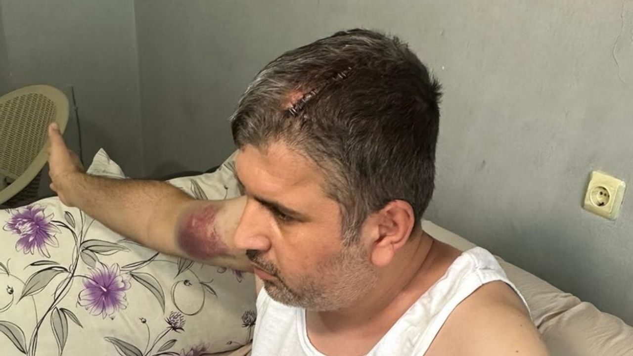 Miras anlaşmazlığı kanlı bitti: Dayı, yeğenini caddede beyzbol sopasıyla darbederek yaraladı