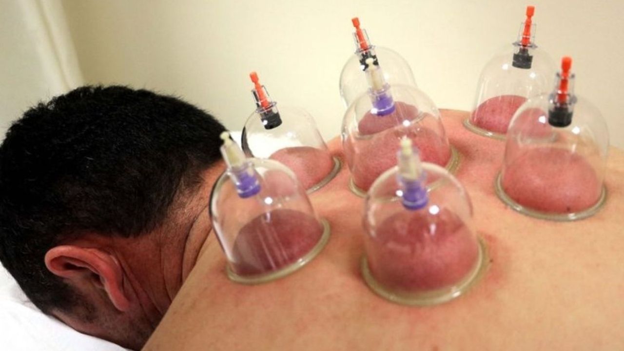 Hacamatın faydaları duyanları şaşırtıyor!