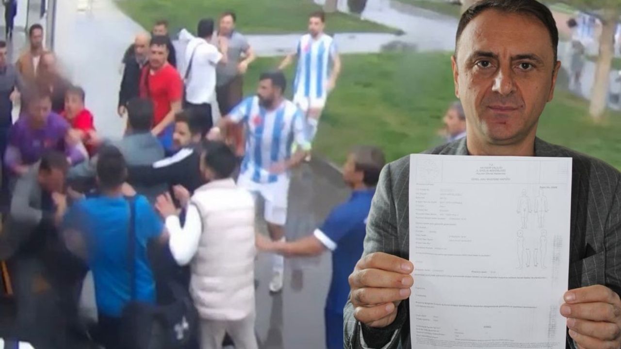 Kayseri’de futbol sahasında kabus: Antrenör ve teknik direktör darp edildi!