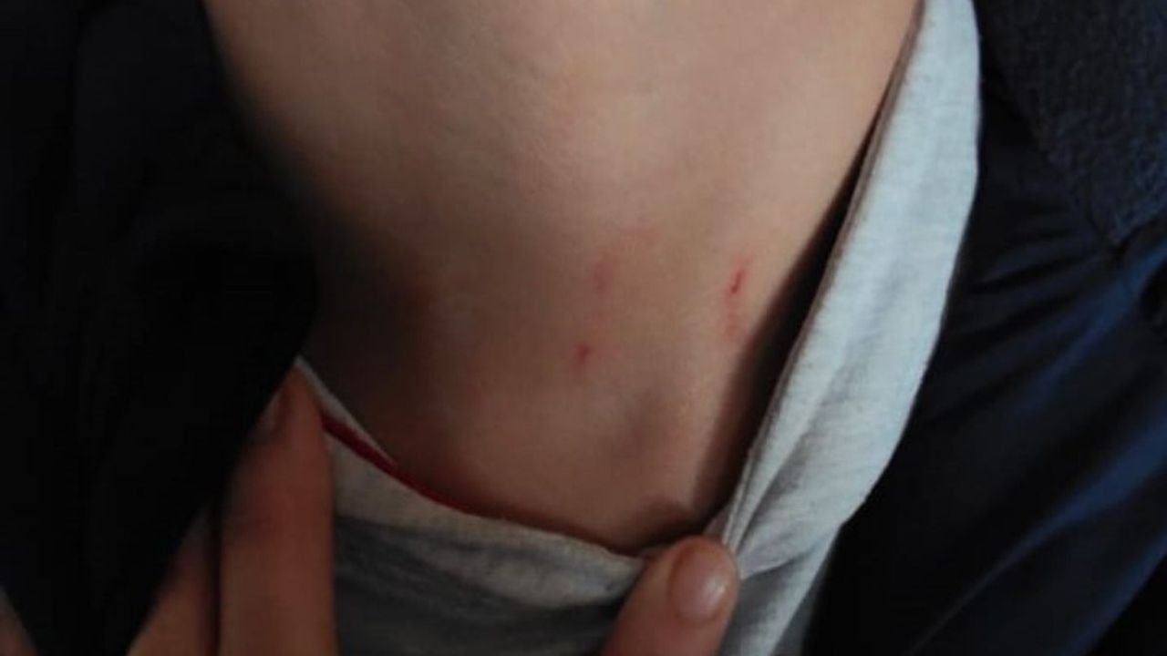 Kayseri’de ilkokul öğrencisini öğretmeni darp etti