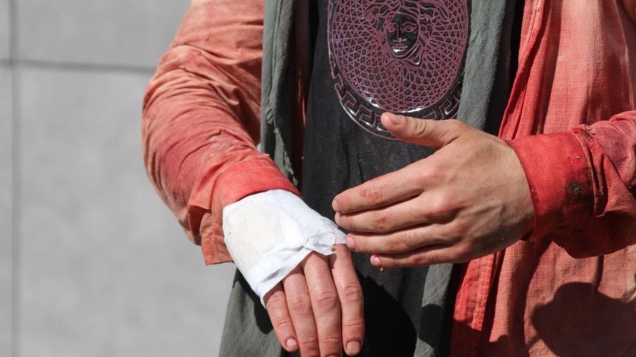 Adana'da bayram klasiği! ‘13 dakikada keserim’ dedi kendini yaraladı