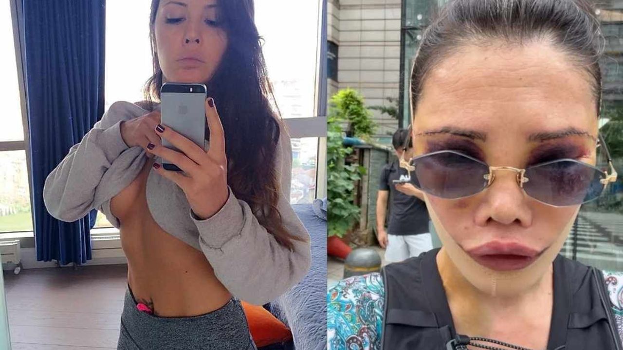 Yüz nakli olan fenomen son haliyle herkesi korkuttu