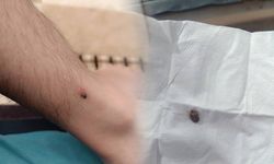 Kayseri’nin kene kâbusu geri döndü!