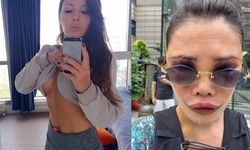 Yüz nakli olan fenomen son haliyle herkesi korkuttu