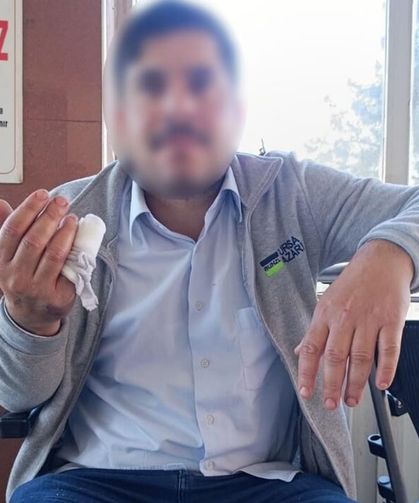 Tosun darbesiyle yaralandı: 60 dikiş atıldı