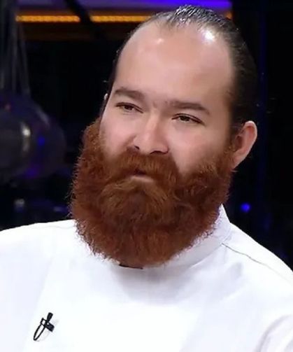 Kızıl Sakal lakaplı Masterchef Şampiyonu Eren Kaşıkçı’nın ölüm nedeni belli oldu