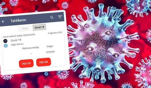 Covid 19 testi pozitif çıkan hastayı hastanede ‘yer yok’ diye eve gönderdiler