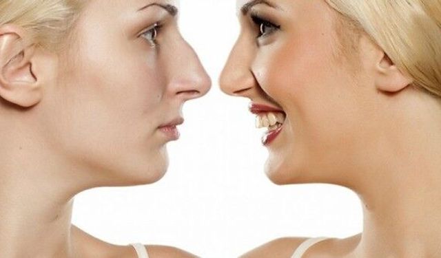 Gençler burun estetiğini daha çok yaptırıyor  