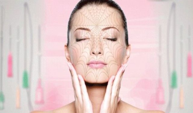 İple yüz germe ile yüzdeki sarkmalara son  