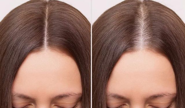 İnsan Kök Hücresiyle Saçların Rengini Değiştirmek Mümkün mü?