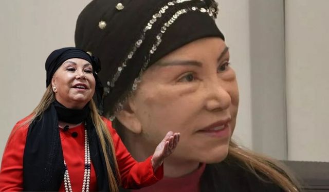 Estetik olan 85 yaşındaki usta sanatçının son halini gören tanıyamadı!